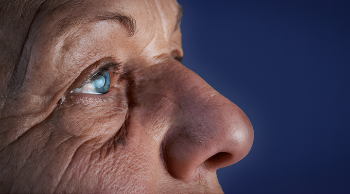 Adult Cataract Surgery in Lahore